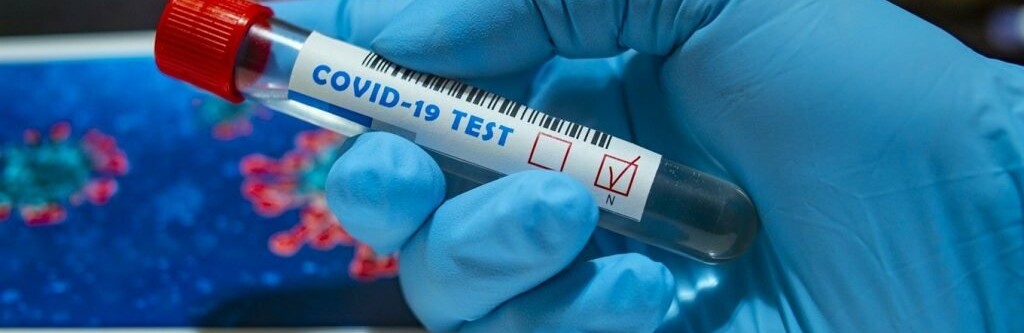 У Житомирі подешевшали тести на коронавірус У Житомирі подешевшали тести на коронавірус, Ketlandia