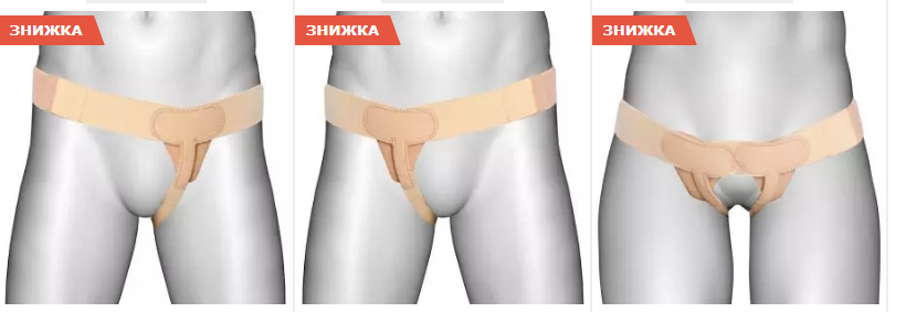 пояс при пупковій грижі